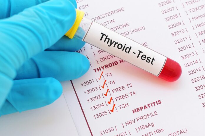 Анализ крови на гормоны щитовидной железы: ТТГ, Т4