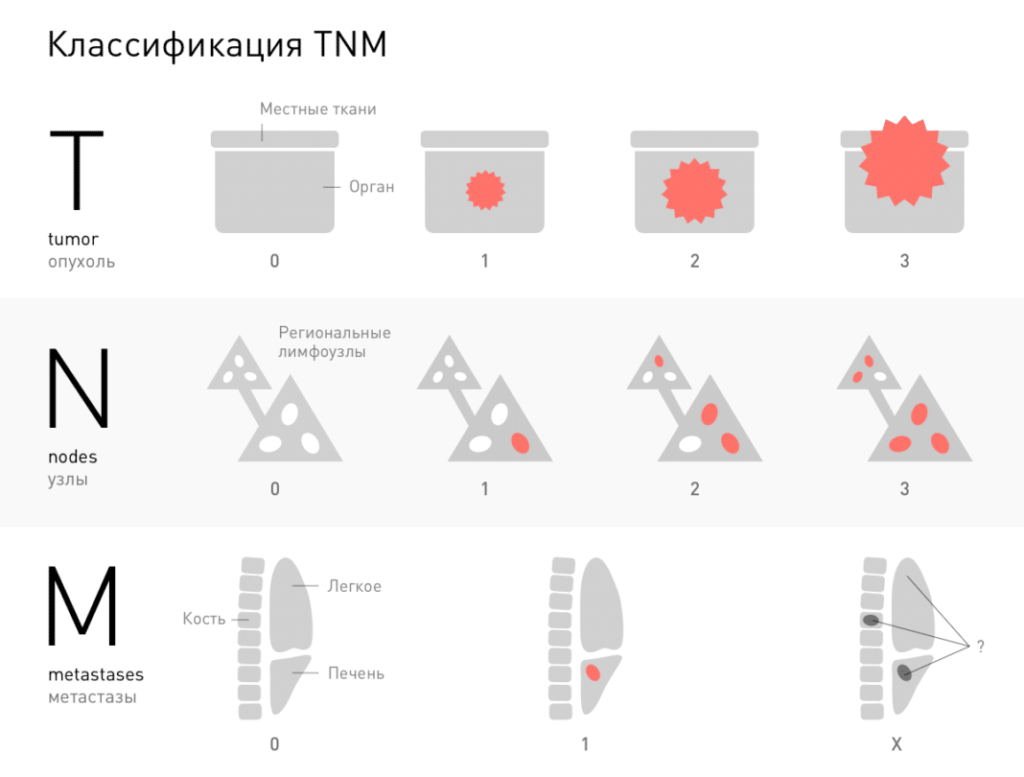 TNM-классификация