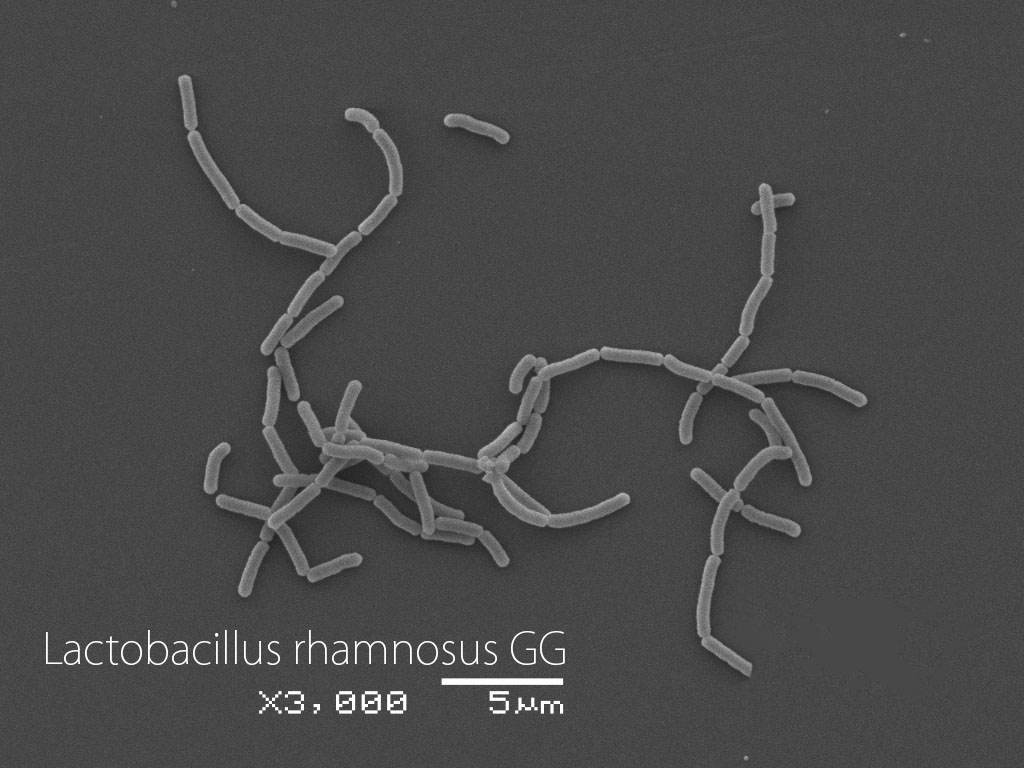 Lactobacillus rhamnosus GG (LGG)