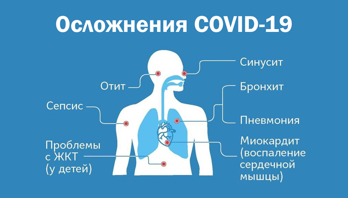 Ковид смертелен. Осложнения при коронавирусе. Короновирусная инфекция осложнения. Осложнения после коронавируса. Профилактика осложнений коронавируса.